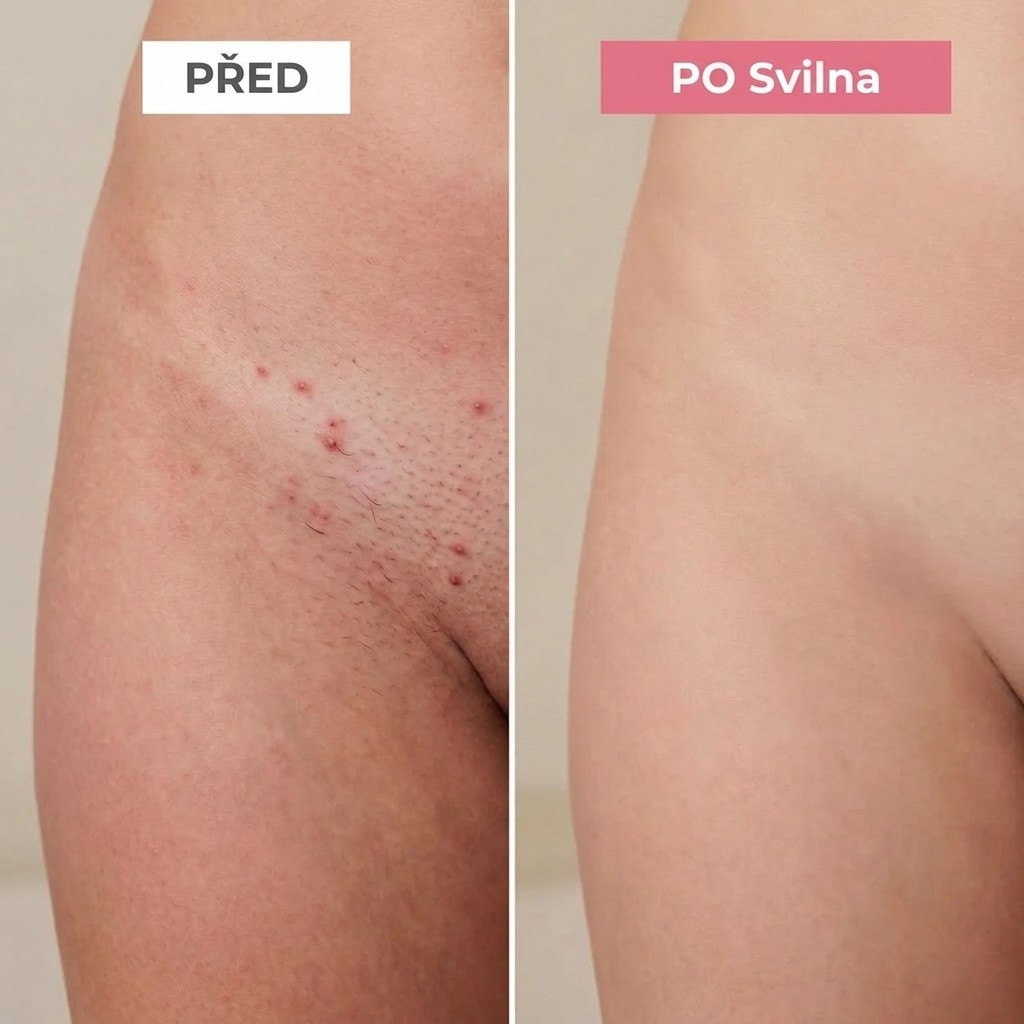 SVILNA | Jemné řešení pro všechny citlivé zóny