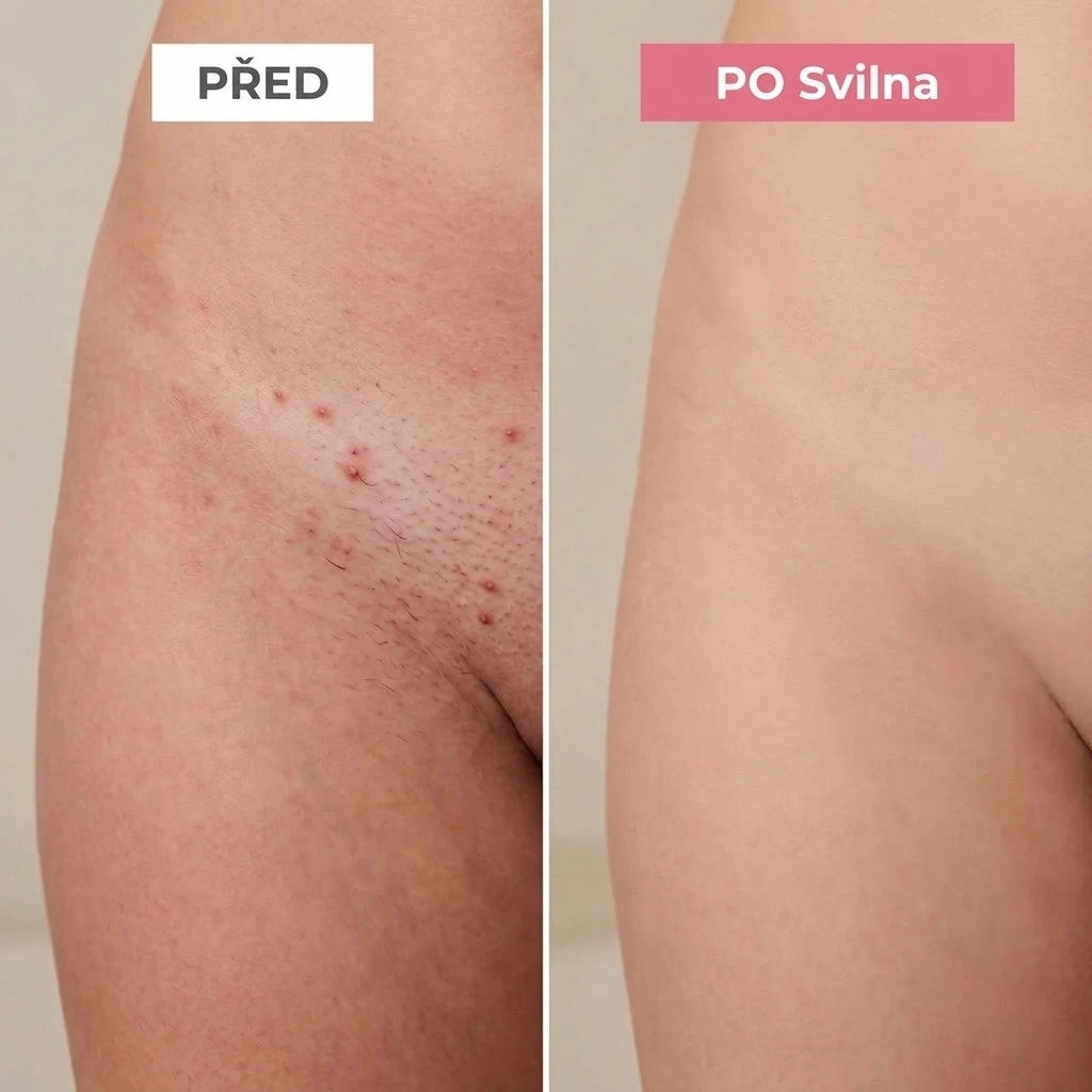 Svilna | Jemné řešení pro všechny citlivé zóny