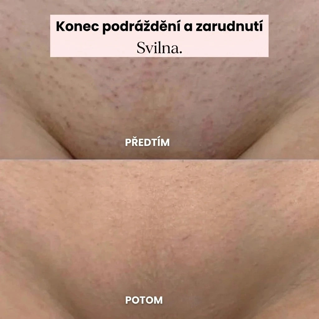 Svilna | Jemné řešení pro všechny citlivé zóny