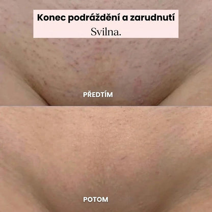 Svilna | Jemné řešení pro všechny citlivé zóny